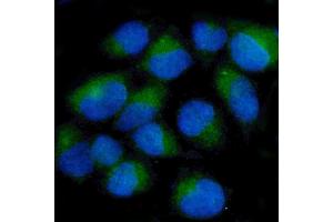 IF analysis of Ch TOG/CKAP5 using anti-Ch TOG/CKAP5 antibody (ABIN7599106). (CKAP5 anticorps  (AA 1-221))