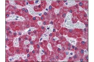 Immunohistochemistry Image: Human Liver: Formalin-Fixed, Paraffin-Embedded (FFPE) (SCD anticorps  (C-Term))