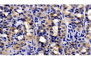 #VALUE! (Urocortin 2 anticorps  (AA 20-112))