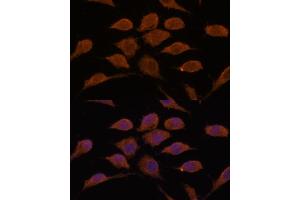 Immunofluorescence analysis of L929 cells using USP19 antibody  at dilution of 1:100.