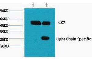 Immunoprecipitation (IP) analysis: 1) Input: HeLa Cell Lysate.