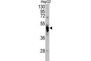 Western blot analysis of GLA antibody (N-term) in Hela cell line lysates (35 µg/lane). (GLA anticorps  (N-Term))