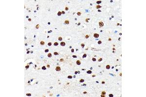 Immunohistochemistry of paraffin-embedded mouse brain using HD antibody (ABIN7267708) at dilution of 1:100 (40x lens). (HDAC2 anticorps)