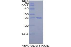 SDS-PAGE analysis of Mouse GRB7 Protein. (GRB7 Protéine)