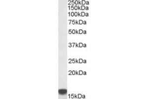 Western Blotting (WB) image for anti-S100 Calcium Binding Protein A9 (S100A9) (Internal Region) antibody (ABIN2466632) (S100A9 anticorps  (Internal Region))