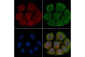 ABIN6260864 and ABIN6266508 staining Hela cells(45 min of heat-shock treatment) by IF/ICC. (Claudin 2 anticorps  (C-Term))
