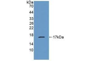 Detection of Recombinant MUC1, Human using Polyclonal Antibody to Mucin 1 (MUC1)