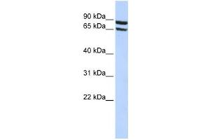 Western Blotting (WB) image for anti-Solute Carrier Family 6 (Neutral Amino Acid Transporter), Member 15 (SLC6A15) antibody (ABIN2458798) (SLC6A15 anticorps)