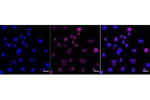 Immunocytochemical staining of C2C12 cells with Phospho-MEK1 (T292) antibody (ABIN7799463), 1:1,000). (Recombinant MEK1 anticorps  (pThr292))