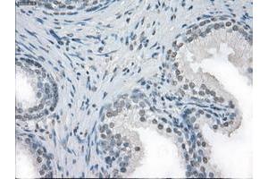 Image no. 7 for anti-Fc Fragment of IgG, Low Affinity IIa, Receptor (CD32) (FCGR2A) antibody (ABIN1497259)