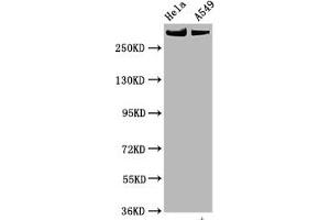Western Blot Positive WB detected in Hela whole cell lysate,A549 whole cell lysate All lanes Phospho-MTOR antibody at 0. (Recombinant MTOR anticorps  (pSer2448))
