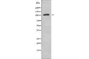 Western blot analysis of extracts from K562 cells, using RPS6KC1 antibody. (RPS6KC1 anticorps  (Internal Region))