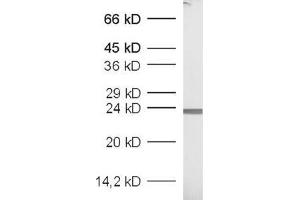 dilution: 1 : 1000, sample: recombinant protein (GFP anticorps  (AA 183-191))