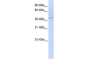 LAX1 antibody used at 1 ug/ml to detect target protein. (LAX1 anticorps  (Middle Region))