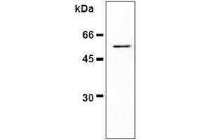 Western Blotting (WB) image for anti-Vimentin (VIM) antibody (ABIN1109487) (Vimentin anticorps)