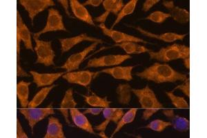 Immunofluorescence analysis of L929 cells using ZC3H7A Polyclonal Antibody at dilution of 1:100.