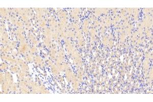 Detection of TMOD3 in Mouse Kidney Tissue using Polyclonal Antibody to Tropomodulin 3 (TMOD3)