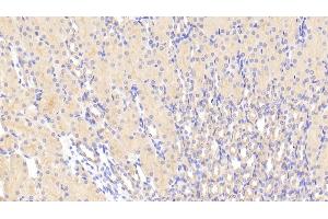Detection of TMOD3 in Mouse Kidney Tissue using Polyclonal Antibody to Tropomodulin 3 (TMOD3) (TMOD3 anticorps  (AA 1-352))