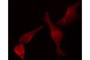 anti-Secretin Receptor (SCTR) (Internal Region) antibody