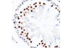 Immunohistochemistry of paraffin-embedded rat testis using PI+PI Rabbit mAb (ABIN7266879) at dilution of 1:100 (40x lens). (E3 SUMO-Protein Ligase PIAS3 (LOC101740849) anticorps)