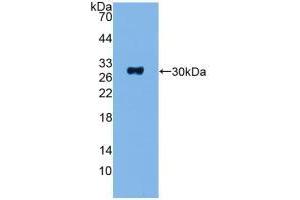 Western blot analysis of recombinant Human ADCY1. (ADCY1 anticorps  (AA 835-1061))