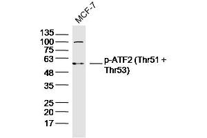MCF-7 lysates probed with p-ATF2 (Thr51 + Thr53) Polyclonal Antibody, Unconjugated  at 1:300 dilution and 4˚C overnight incubation. (ATF2 anticorps  (pThr51, pThr53))