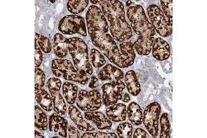 Immunohistochemical staining of human kidney with AGXT2 polyclonal antibody  shows strong cytoplasmic positivity in renal tubules at 1:50-1:200 dilution. (AGXT2 anticorps)