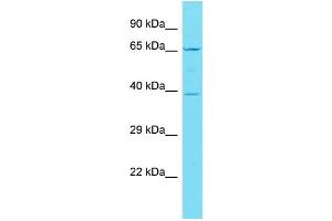 Host: Rabbit Target Name: C19orf67 Sample Type: Jurkat Whole Cell lysates Antibody Dilution: 1. (C19ORF67 anticorps  (N-Term))