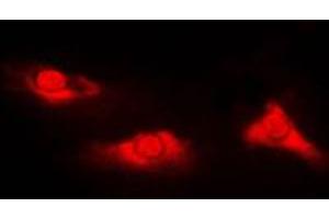 Immunofluorescent analysis of DJ-1 staining in Jurkat cells.