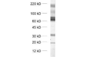 dilution: 1 : 1000, sample: synaptic membrane fraction (LP1) of rat brain (SLC1A3 anticorps  (Cytoplasmic Domain))