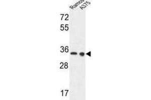 Western Blotting (WB) image for anti-Lactate Dehydrogenase A (LDHA) antibody (ABIN3004211) (Lactate Dehydrogenase A anticorps)