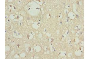 Immunohistochemistry of paraffin-embedded human brain tissue using ABIN7163186 at dilution of 1:100 (PIP5K1B anticorps  (AA 190-470))
