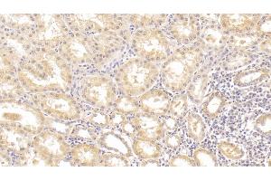 Detection of ALT in Human Kidney Tissue using Monoclonal Antibody to Alanine Aminotransferase (ALT) (ALT anticorps  (AA 255-492))