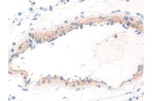 DAB staining on IHC-P; Samples: Rat Lung Tissue (WARS anticorps  (AA 140-347))
