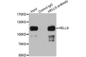 Immunoprecipitation analysis of 200ug extracts of 293T cells using 1ug HELLS antibody. (HELLS anticorps  (AA 719-838))