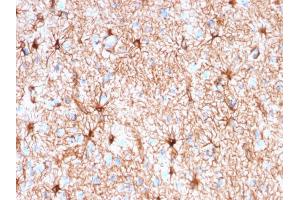Formalin-fixed, paraffin-embedded human Cerebellum stained with GFAP Mouse Recombinant Monoclonal Antibody (rASTRO/789).