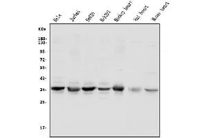 Western blot analysis of UNG using anti-UNG antibody (ABIN7602695).