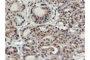 Image no. 8 for anti-Farnesyl-Diphosphate Farnesyltransferase 1 (FDFT1) antibody (ABIN1498243)