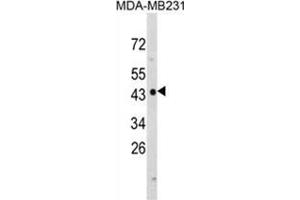 Western blot analysis of NDRG1 Antibody (N-term) in MDA-MB231 cell line lysates (35ug/lane). (NDRG1 anticorps  (N-Term))