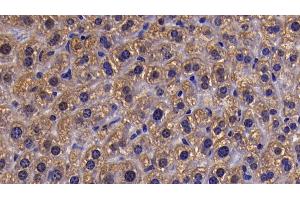 Detection of SIRT5 in Mouse Liver Tissue using Polyclonal Antibody to Sirtuin 5 (SIRT5)