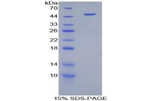 SDS-PAGE analysis of Human Furin Protein.
