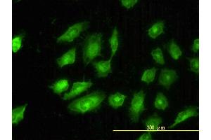 Immunofluorescence of monoclonal antibody to TPM4 on HeLa cell. (Tropomyosin 4 anticorps  (AA 1-248))
