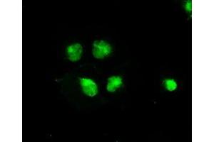 Image no. 9 for anti-B-Raf proto-oncogene, serine/threonine kinase (BRAF) antibody (ABIN1496951)