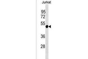 anti-Nuclear RNA Export Factor 5 (NXF5) (AA 53-80), (N-Term) antibody