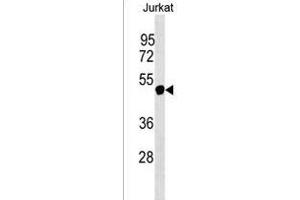 NXF5 Antibody (N-term) (ABIN1539447 and ABIN2849866) western blot analysis in Jurkat cell line lysates (35 μg/lane). (NXF5 anticorps  (N-Term))