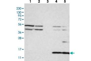 Western blot analysis of Lane 1: RT-4, Lane 2: U-251 MG, Lane 3: Human Plasma, Lane 4: Liver, Lane 5: Tonsil with CYB561D1 polyclonal antibody . (CYB561D1 anticorps)