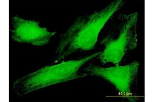 Immunofluorescence of purified MaxPab antibody to PTTG1IP on HeLa cell.