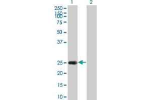 Western Blot analysis of HSPB8 expression in transfected 293T cell line by HSPB8 monoclonal antibody (M02), clone 5D7.