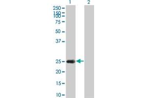 Western Blot analysis of HSPB8 expression in transfected 293T cell line by HSPB8 monoclonal antibody (M02), clone 5D7. (HSPB8 anticorps  (AA 97-196))