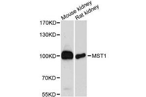 Western blot analysis of extracts of various cell lines, using MST1 antibody. (MST1 anticorps  (AA 200-500))